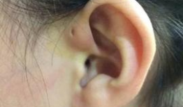 打耳洞视频,跟随视频学习打耳洞全过程